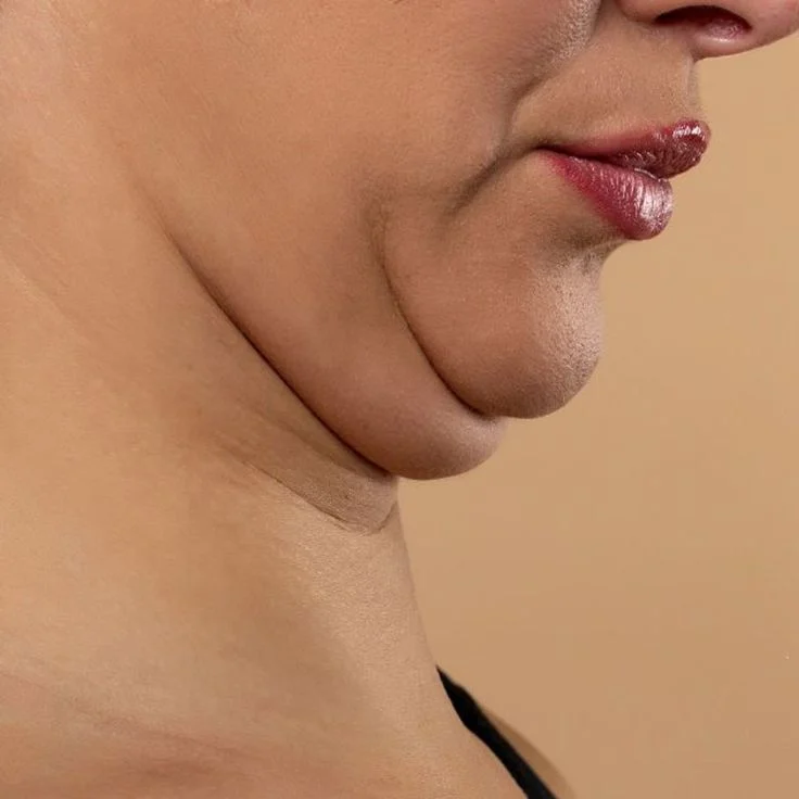 jaw line