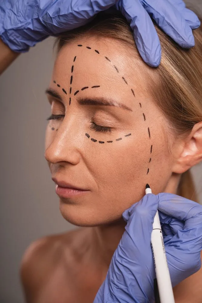 non-surgical face lift